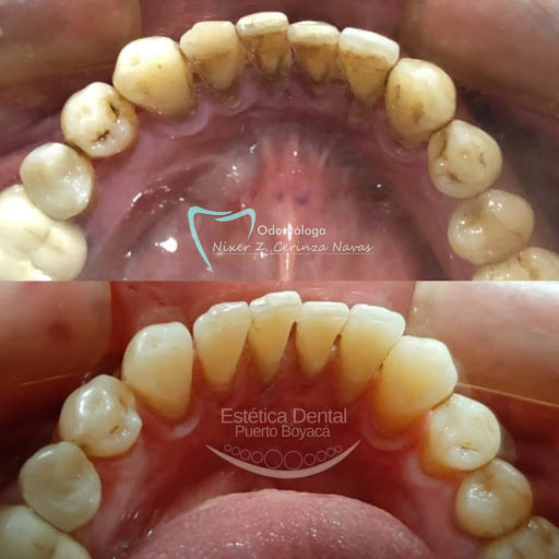 Consltorio Estética Dental Puerto Boyacá.