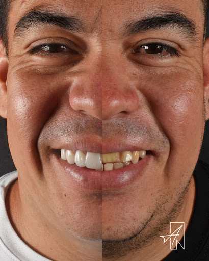 ⭐ Dr. Alejandro Niño l Odontología Yumbo, Cali.